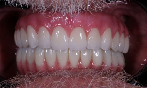 Headshot of after treatment