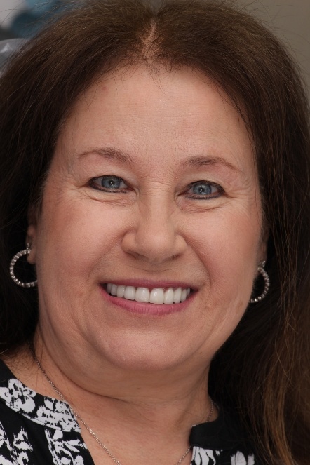 Older woman with teeth enhanced by veneers