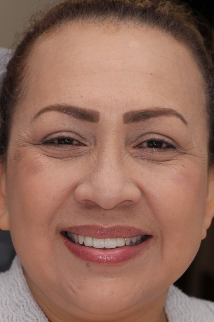 Headshot of Maria after receiving veneers
