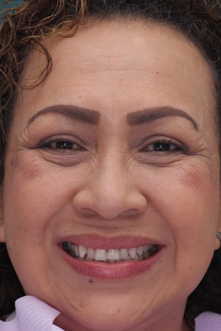 Headshot of Maria before treatment
