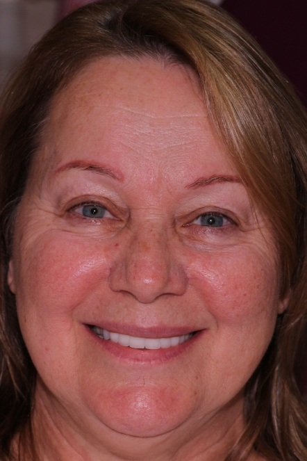  patient after makeover