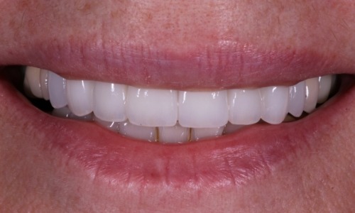  patient closeup after makeover
