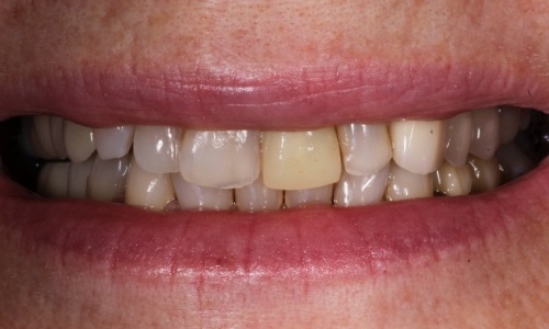  patient closeup before makeover