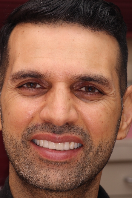 Headshot of Imram showing smile after having veneers placed
