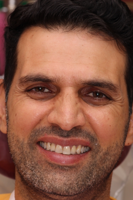 Headshot of Imram showing smile before dental work