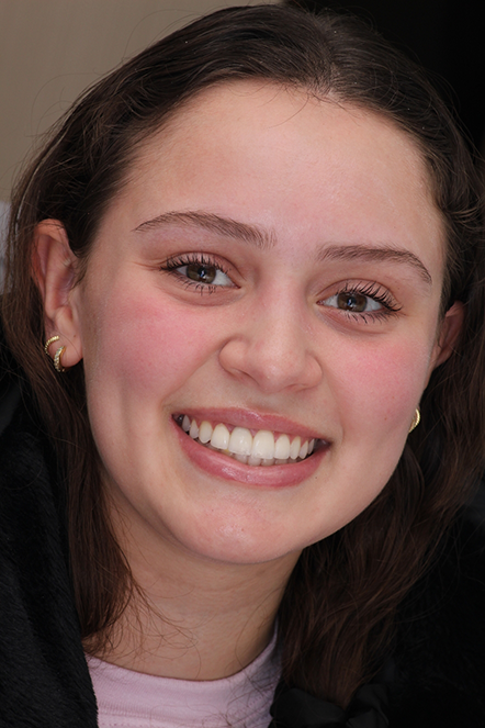 Headshot of Amanda after treatment