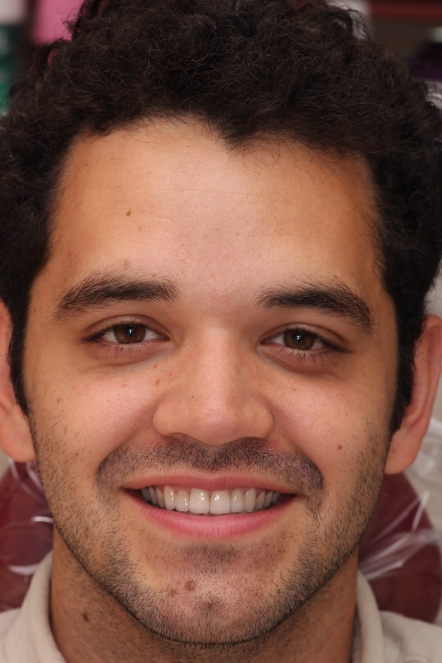 Mr. Avilles smiling after receiving veneers