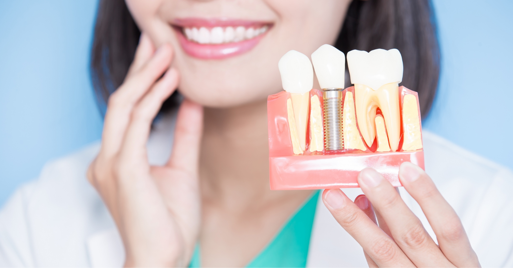 Smiling dentist holding a model of a dental implant in the jawbone