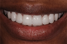 Close-up of Chanique's more confident smile