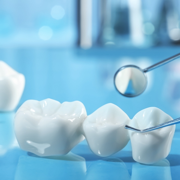 Dental bridge next to a dental mirror