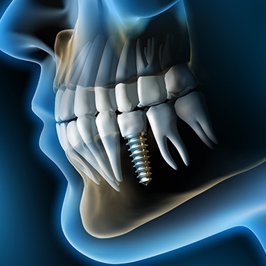 Animation of full jaw and facial bones
