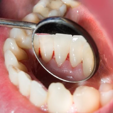 Dr. Mohr checking a dental patient for oral cancer