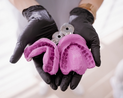 Dentist holding impressions of a patient's teeth