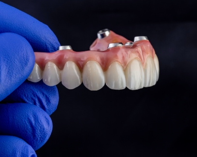 Gloved hand holding an implant denture