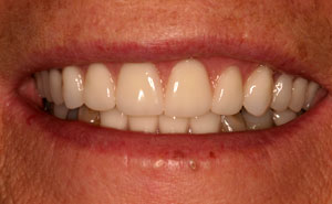 restorative dentistry seaford