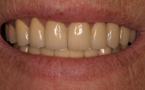 Closeup of flawless healthy smile