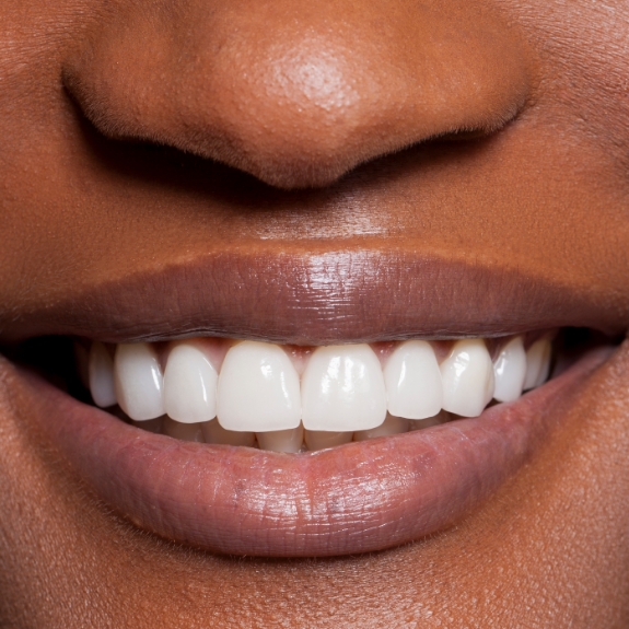 Close up of a person smiling with flawless teeth
