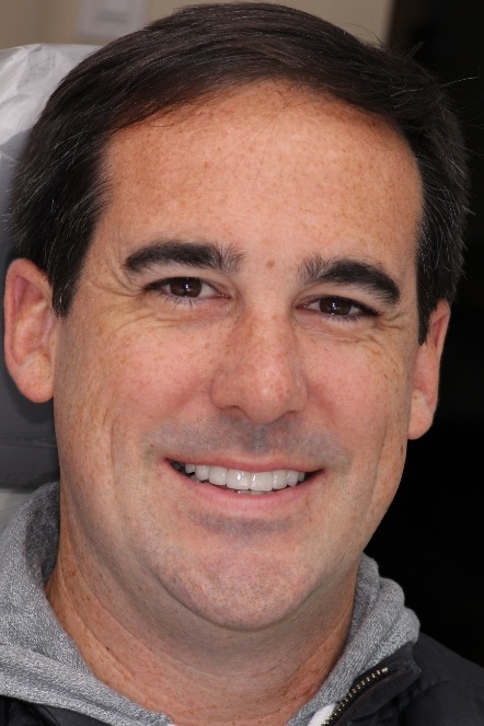 Headshot of Mike after veneers on Long Island from Dr. Allan Mohr