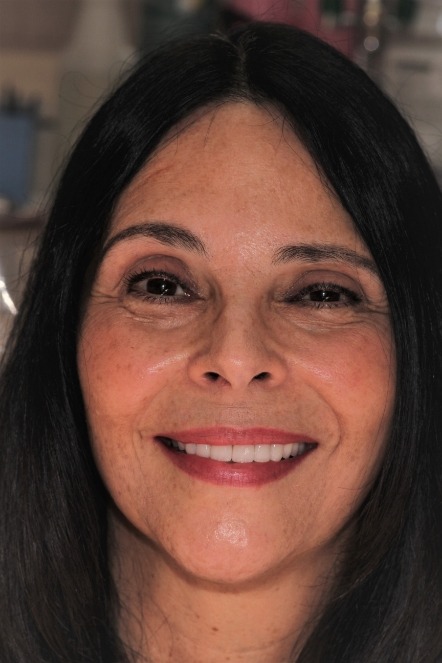 Woman after smile makeover without her glasses