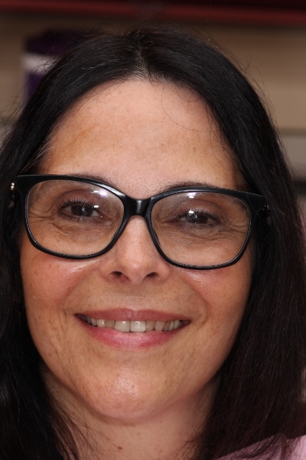 Woman with glasses before smile makeover