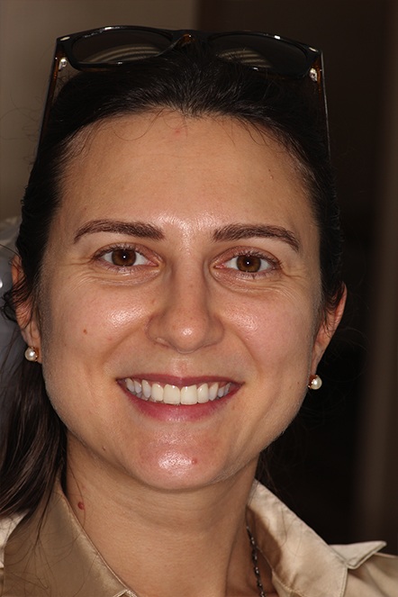 Headshot of Liya after smile makeover