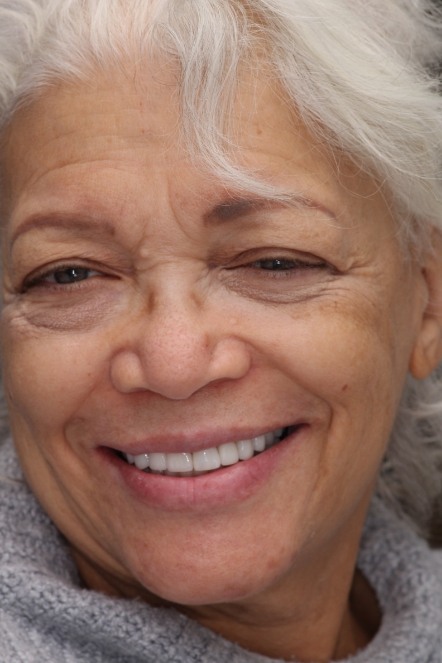 Headshot of Lori after completing smile makeover