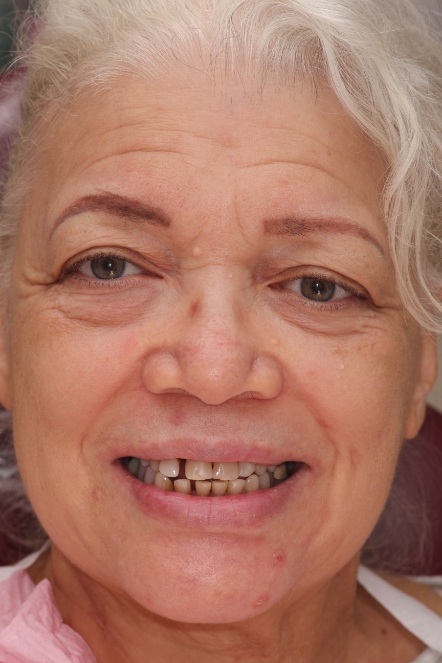 Headshot of Lori before having smile makeover performed
