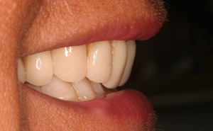 Female makeover patient closeup before treatment