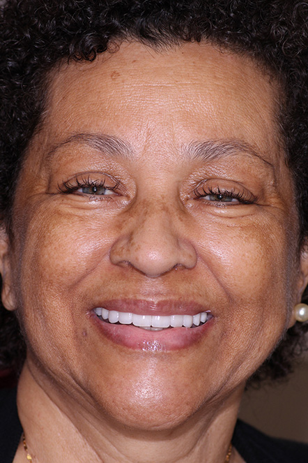 Headshot of Michelle smiling after completing her treatment