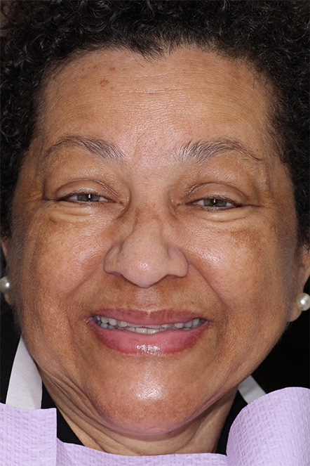 Headshot of Michelle smiling before beginning her treatment