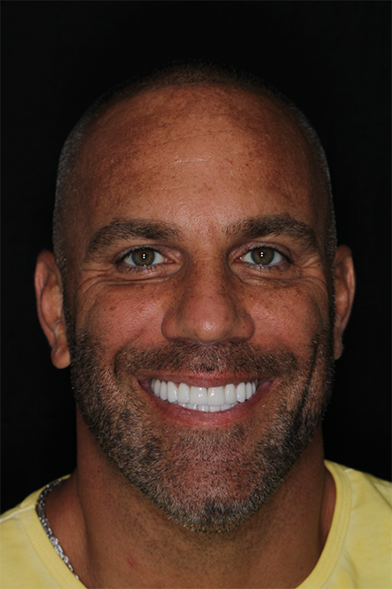 October 2025 patient Justin before treatment