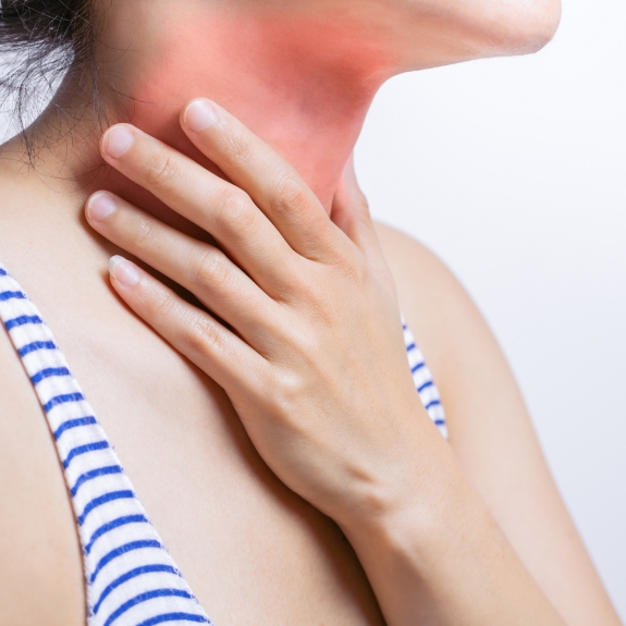 Woman up of a woman holding the front of her neck which has a red splotch