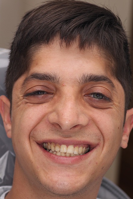 Rich prioer to beginning his dental treatment