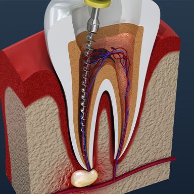 Dr. Mohr checking a dental patient for oral cancer