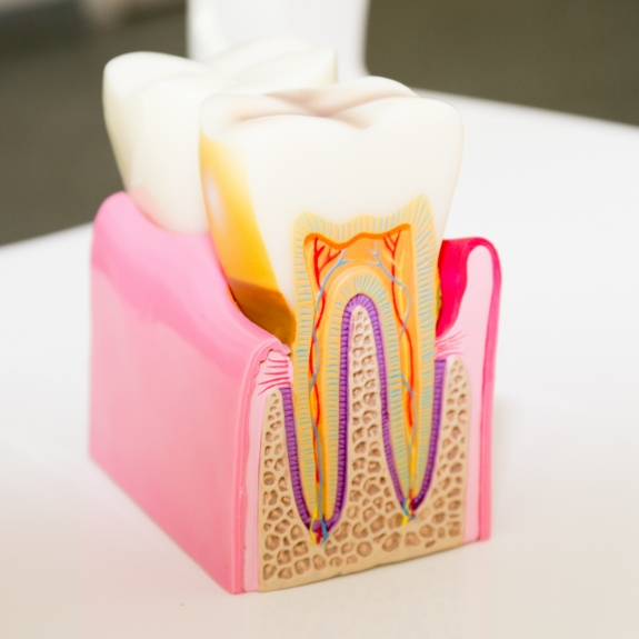 Model of a tooth showing the inner layers