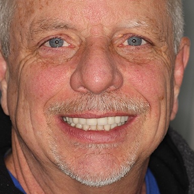 Elderly man with a great smile after a full-mouth reconstruction