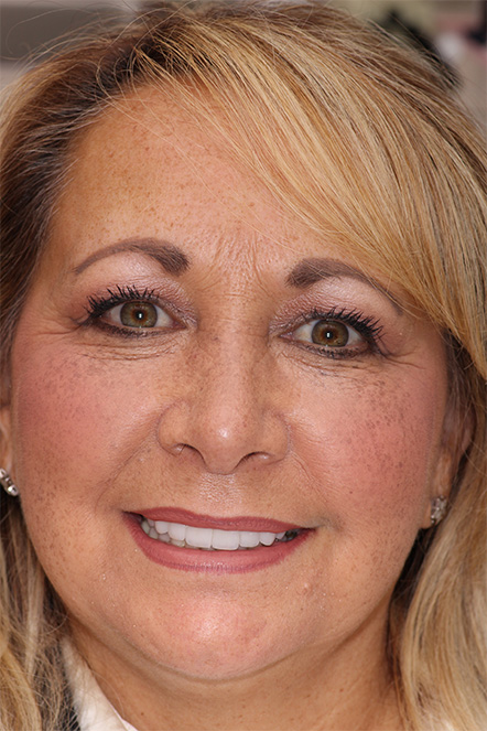 Headshot of Sherri after smile makeover