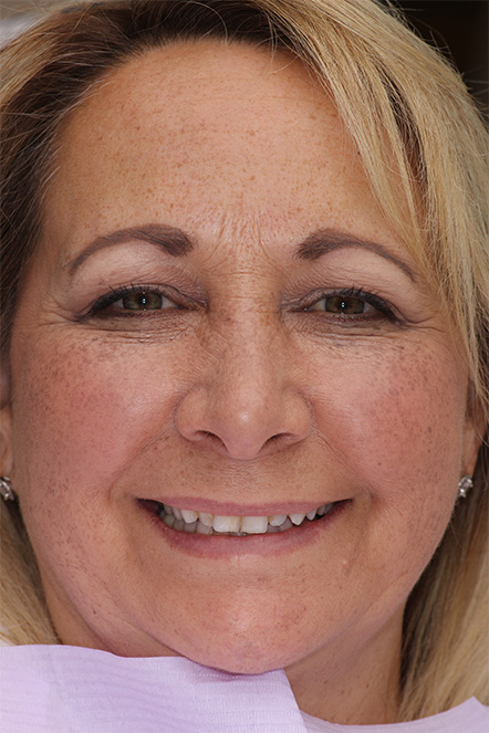 Headshot of Sherri before smile makeover