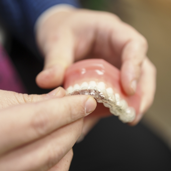 Dentist placing a clear aligner over a model of a row of teeth