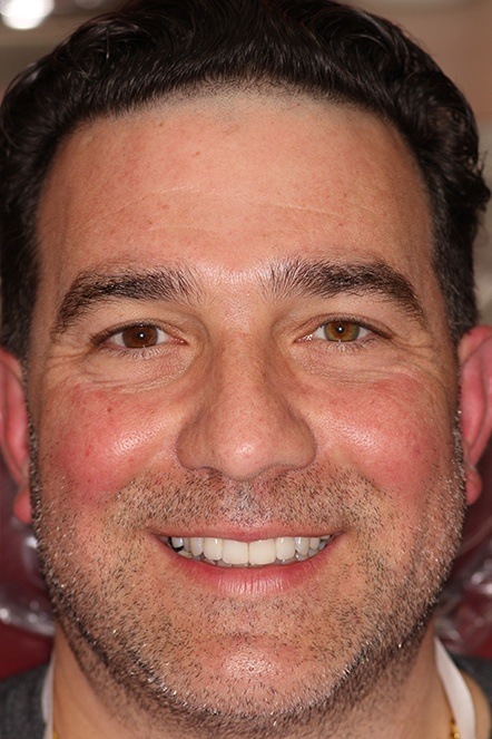 Headshot of January 2020 dental patient after treatment