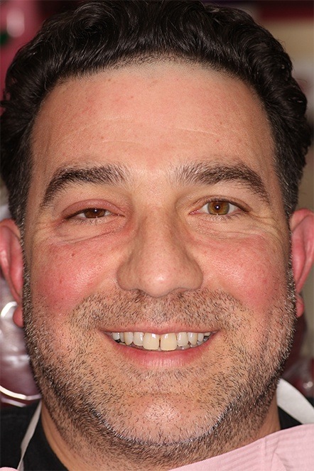 Headshot of January 2020 dental patient before treatment