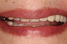 Closeup of Jorgita before treatment