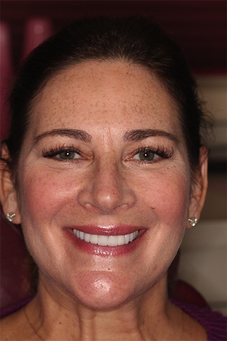 Headshot of April 2020 patient after treatment