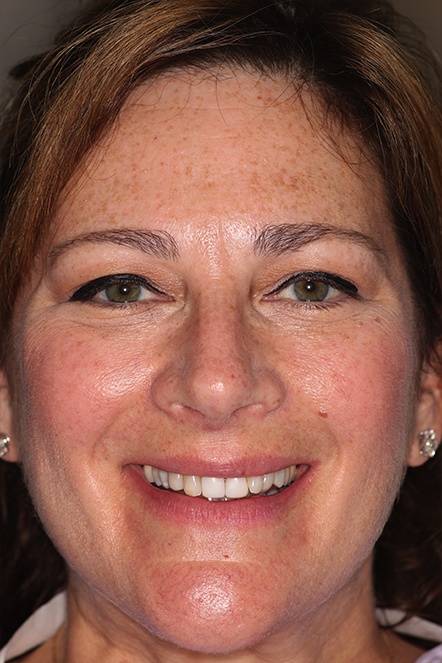 Headshot of April 2020 patient before treatment