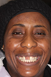 Headshot of dental patient before treatment