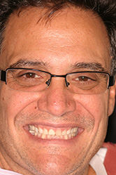 Man with glasses showing smile before dental treatment
