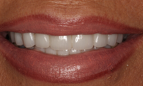 Dental case from August 2016