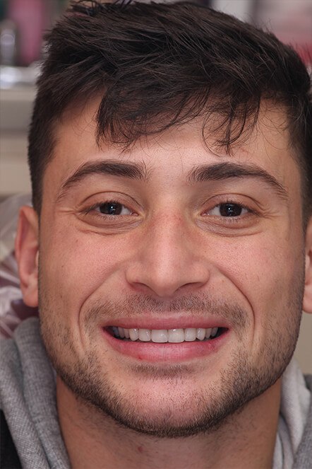 Headshot of August 2021 patient showing newly improved smile