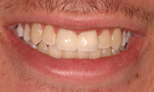 Close-up of a noticeably yellowed smile