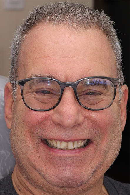 December 2021 patient with chipped teeth